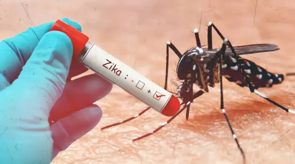 Zika Virus