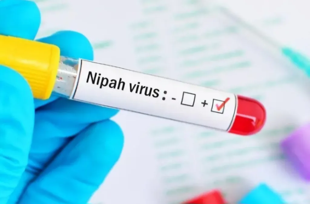 Nipah Virus